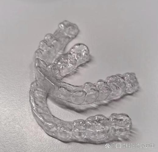 牙齿矫正会让牙齿松动吗?-图2 牙齿矫正会让牙齿松动吗?-图2
