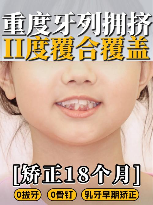 广州矫正牙齿哪里好？求推荐靠谱机构或医生？-图2