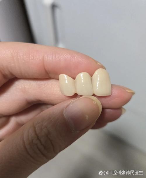 南京牙齿矫正和烤瓷牙怎么选？效果与价格哪个重要？-图1