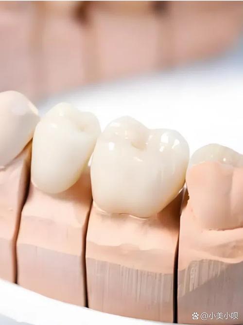 南京牙齿矫正和烤瓷牙怎么选？效果与价格哪个重要？-图3