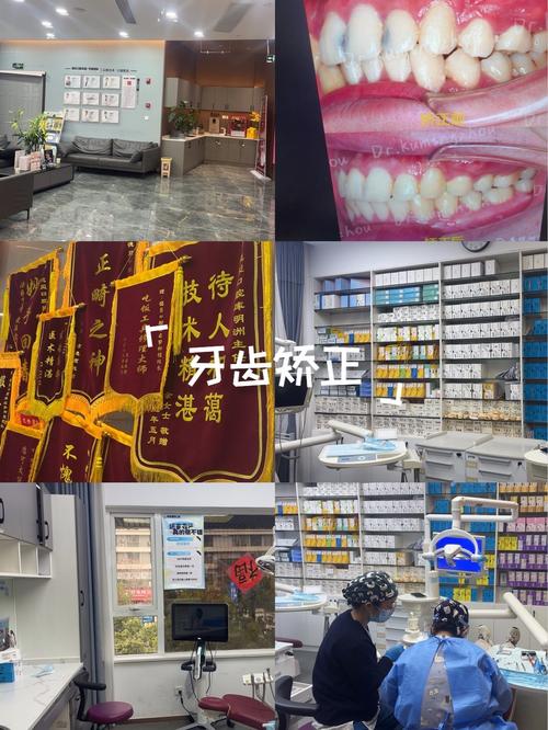 杭州矫正牙齿哪里好?专业机构怎么选?-图1 杭州矫正牙齿哪里好?专业机构怎么选?-图1
