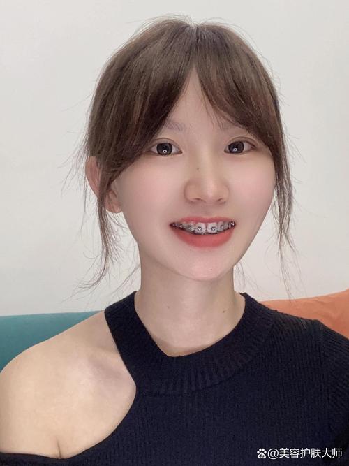 矫正牙齿会导致牙齿松动吗？-图2