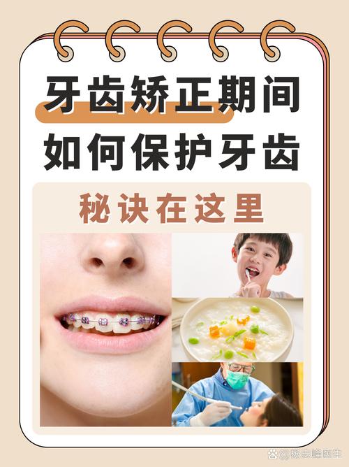 自己矫正牙齿靠谱吗？这些小窍门真能帮上忙吗？-图1