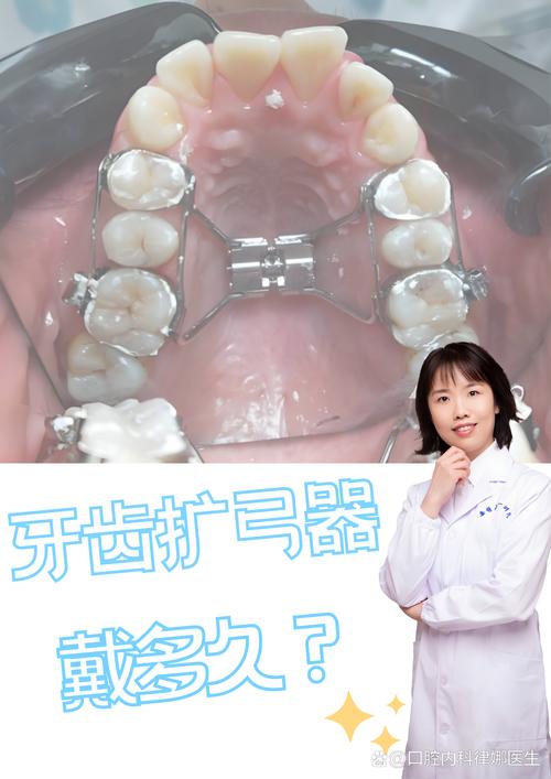 矫正牙齿一般需要多久才能看到明显的矫正效果?-图2 矫正牙齿一般需要多久才能看到明显的矫正效果?-图2