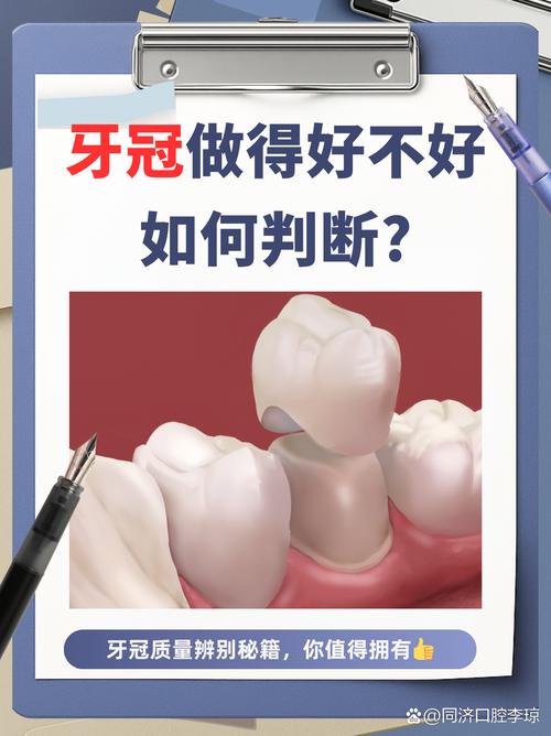 美容冠矫正牙齿好吗-图2