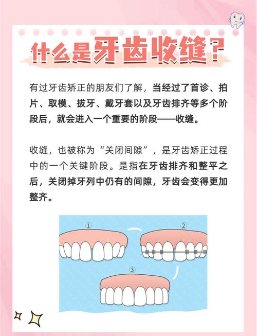 牙齿矫正原理是什么-图2