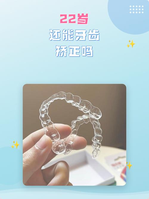 22岁能矫正牙齿吗-图1 22岁能矫正牙齿吗-图1