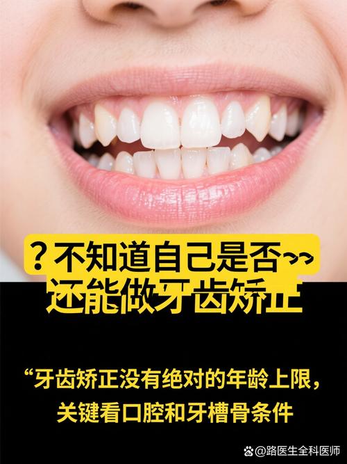 30岁矫正牙齿,后悔的原因究竟是什么?-图2 30岁矫正牙齿,后悔的原因究竟是什么?-图2