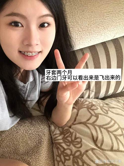 30岁矫正牙齿,后悔的原因究竟是什么?-图1 30岁矫正牙齿,后悔的原因究竟是什么?-图1