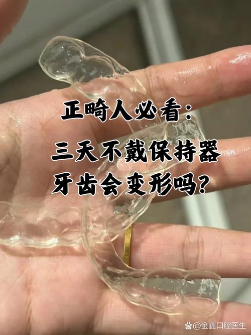 矫正牙齿到底好不好-图1 矫正牙齿到底好不好-图1