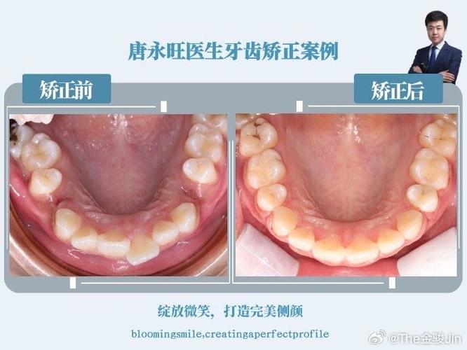 长春矫正牙齿哪家好？如何选靠谱医院？-图2