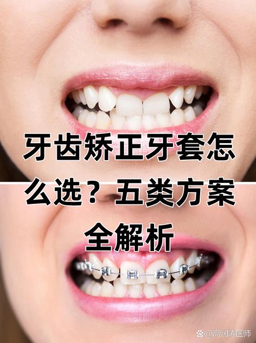 重庆哪里矫正牙齿好-图3