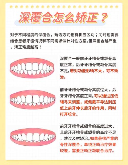 牙齿深覆盖怎么矫正-图2