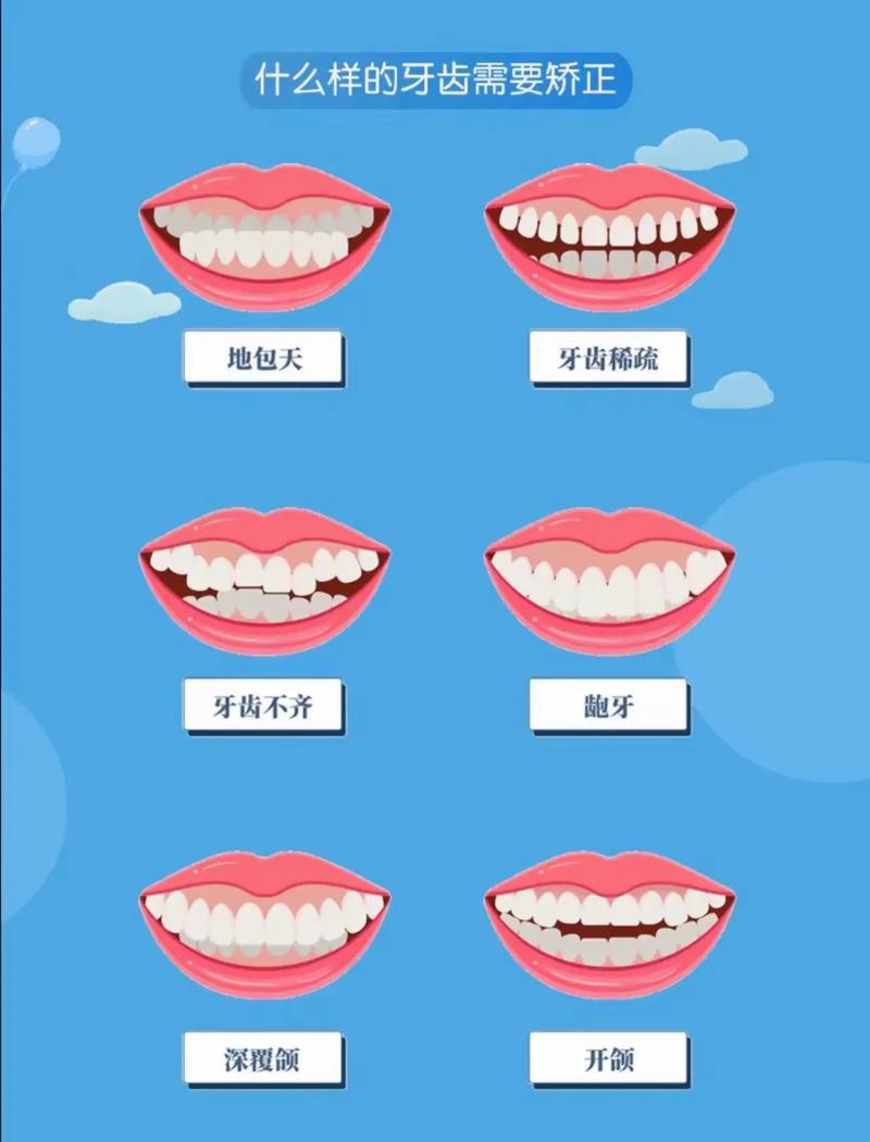 武汉矫正牙齿多少钱-图2