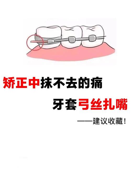 矫正牙齿钢丝刺到嘴，是什么原因？该如何处理？-图2