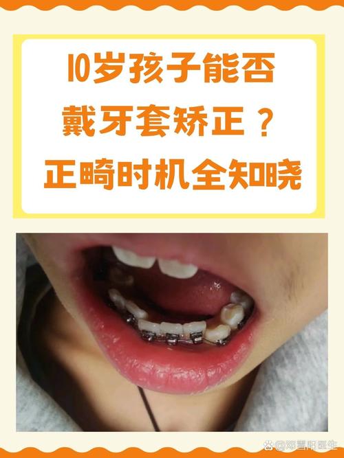 北京幼儿牙齿矫正，早期矫正有必要吗？-图1