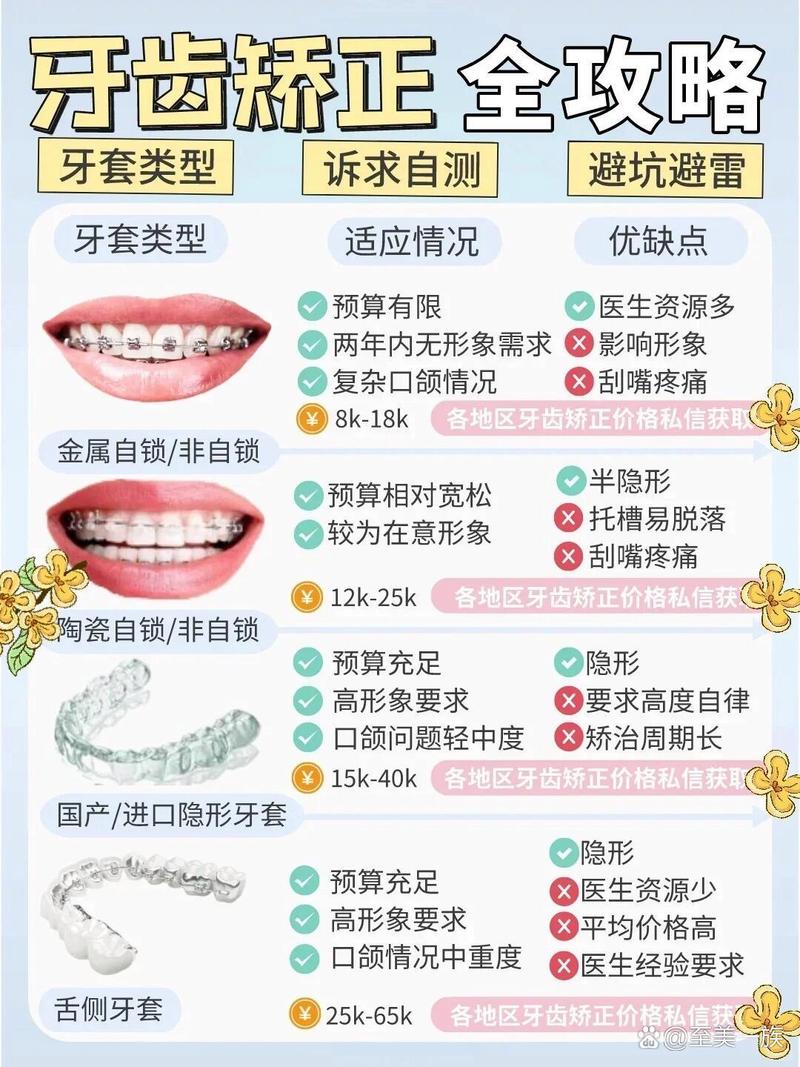 成人矫正价位多少?影响因素有哪些?-图3 成人矫正价位多少?影响因素有哪些?-图3