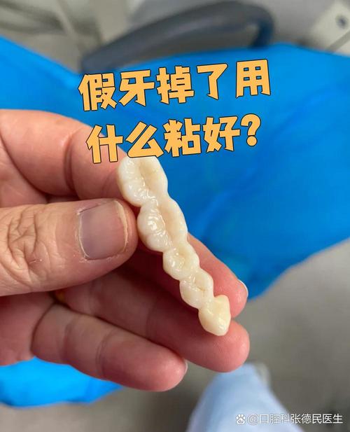 矫正牙齿附件掉落了，该怎么处理？会影响矫正效果吗？-图2
