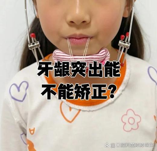 小孩牙齿矫正酸痛？原因和缓解方法是什么？-图3