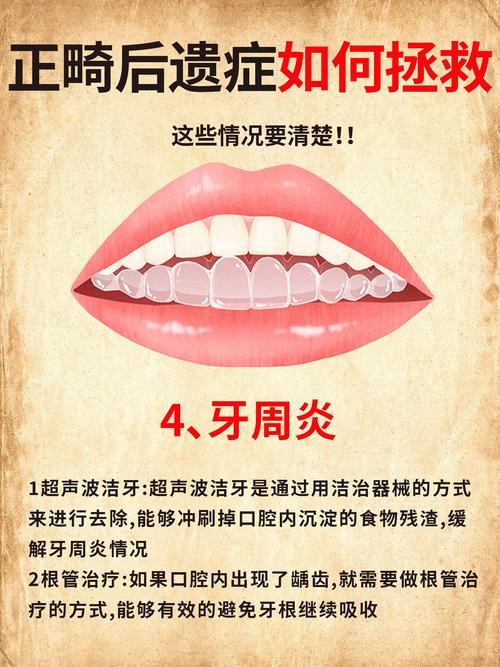 皮圈矫正牙齿危害-图2