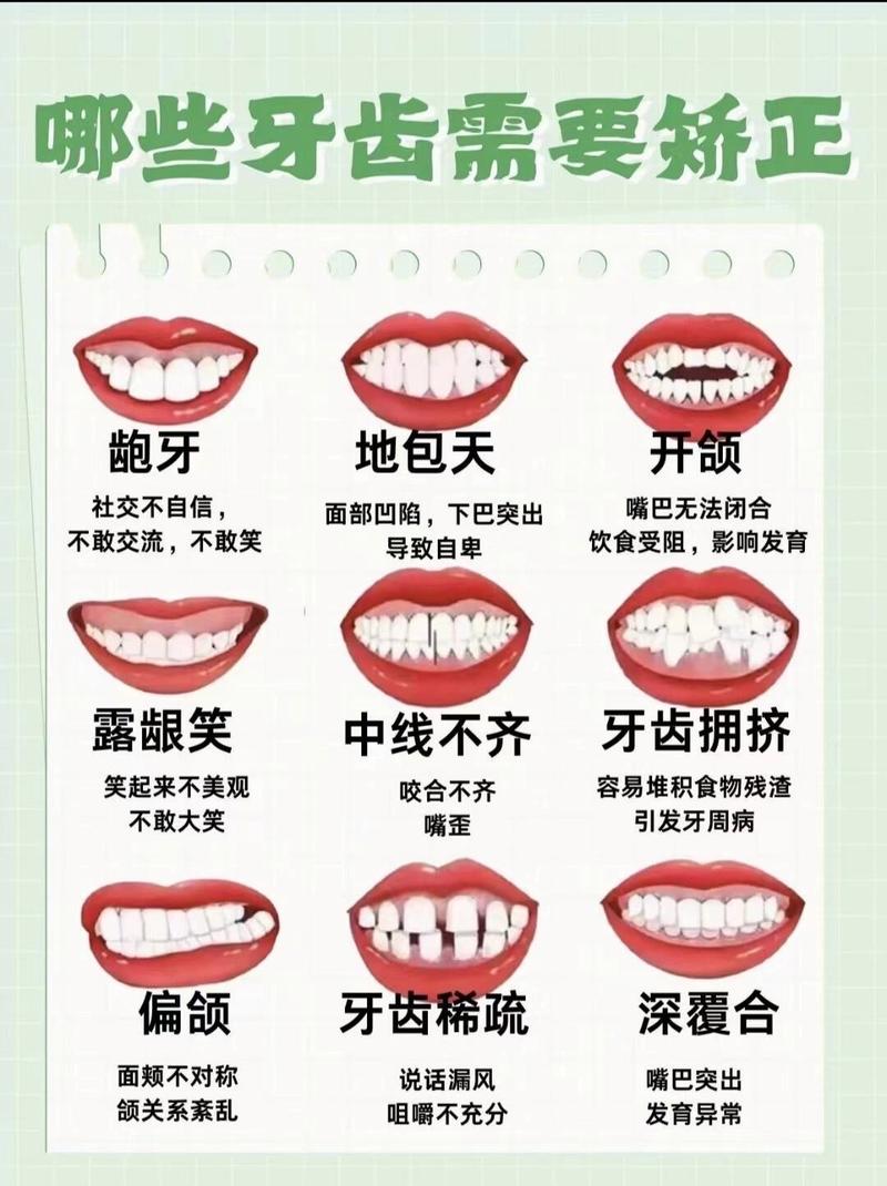 为啥要做牙齿矫正?这些健康与美观的关键原因你get了吗?-图2 为啥要做牙齿矫正?这些健康与美观的关键原因你get了吗?-图2