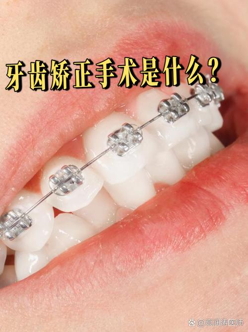 矫正牙齿保守治疗适用哪些情况？效果如何？-图2