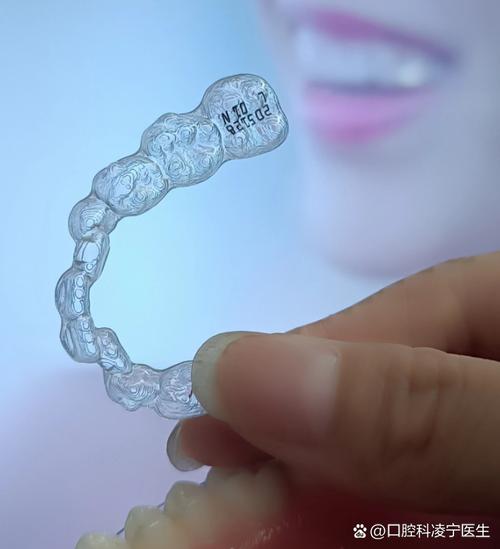 金属冰晶矫正牙齿与传统矫正有何不同?-图1 金属冰晶矫正牙齿与传统矫正有何不同?-图1