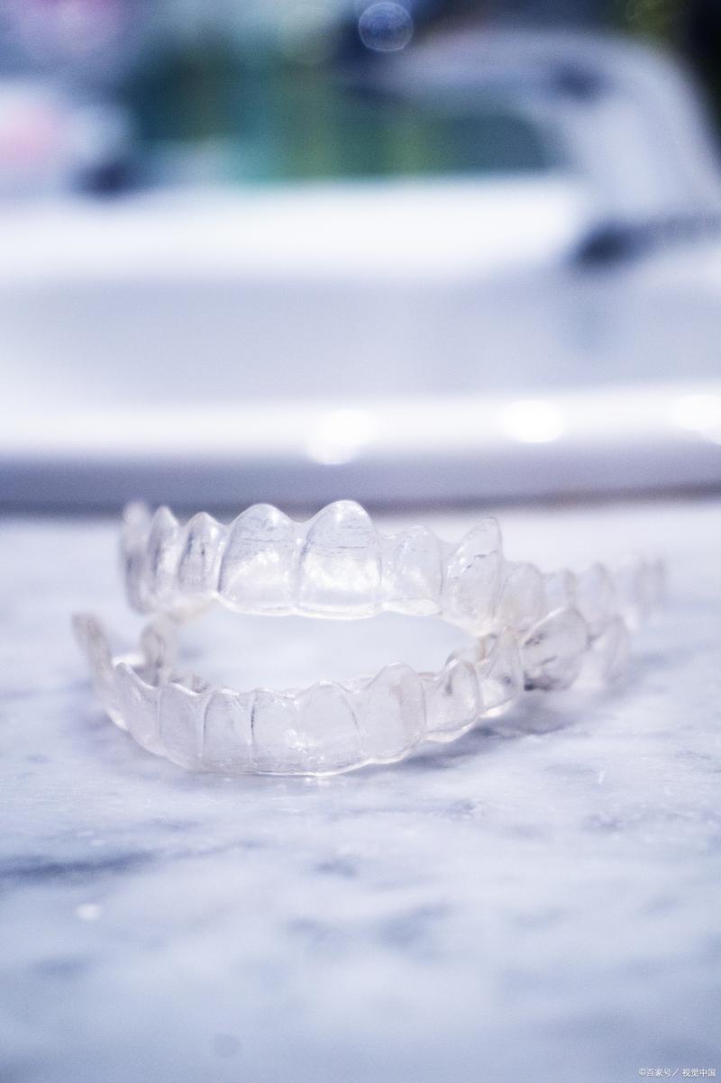 金属冰晶矫正牙齿与传统矫正有何不同?-图2 金属冰晶矫正牙齿与传统矫正有何不同?-图2