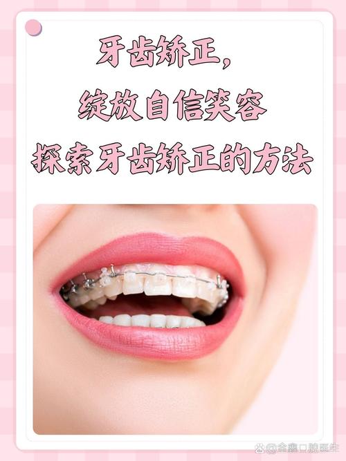 冰晶矫正牙齿效果如何？安全舒适吗？-图1