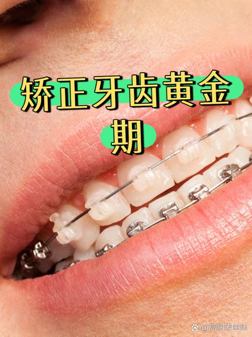 拉萨牙齿矫正去哪里做比较好？-图2