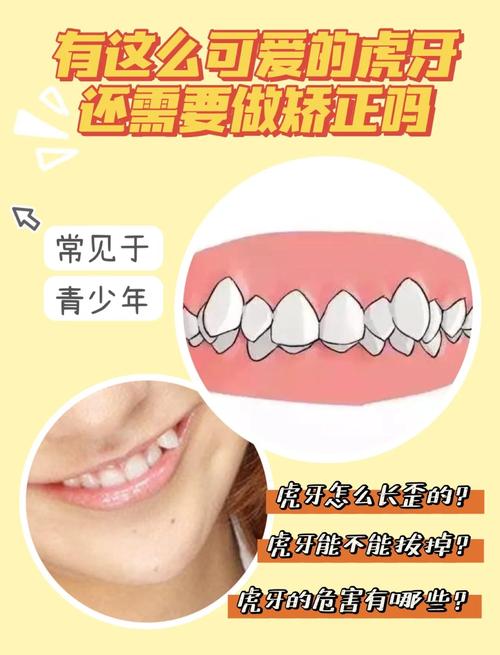 矫正牙齿取了虎牙-图1