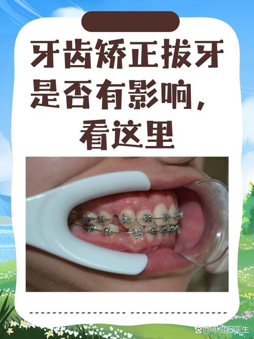 牙齿矫正拔牙少了,矫正效果会受影响吗?-图1 牙齿矫正拔牙少了,矫正效果会受影响吗?-图1