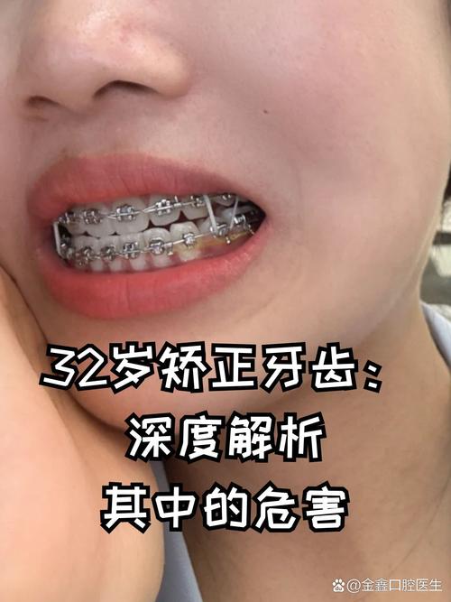 常熟在哪牙齿矫正-图1