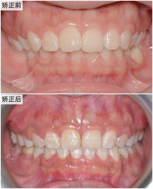 深圳远东牙齿矫正效果如何？价格贵不贵？医生技术靠谱吗？-图1