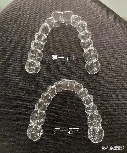 隐形矫正牙齿透明-图1