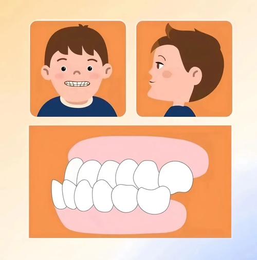 成人矫正牙齿，动画如何帮你懂矫正过程？-图3