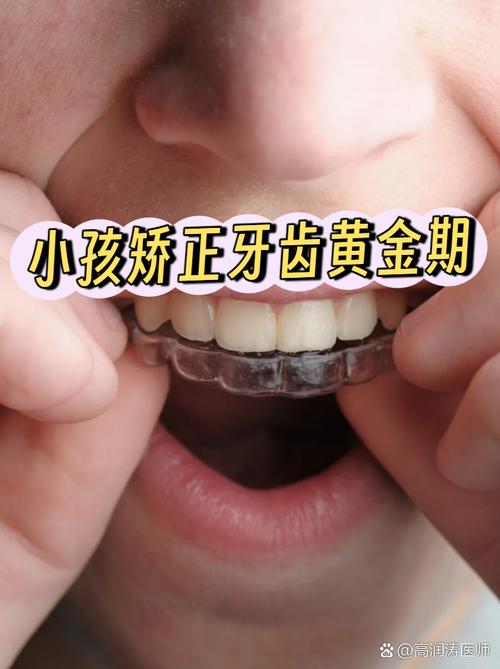 苏州小孩矫正牙齿,最佳年龄、方法及费用如何选?-图3 苏州小孩矫正牙齿,最佳年龄、方法及费用如何选?-图3