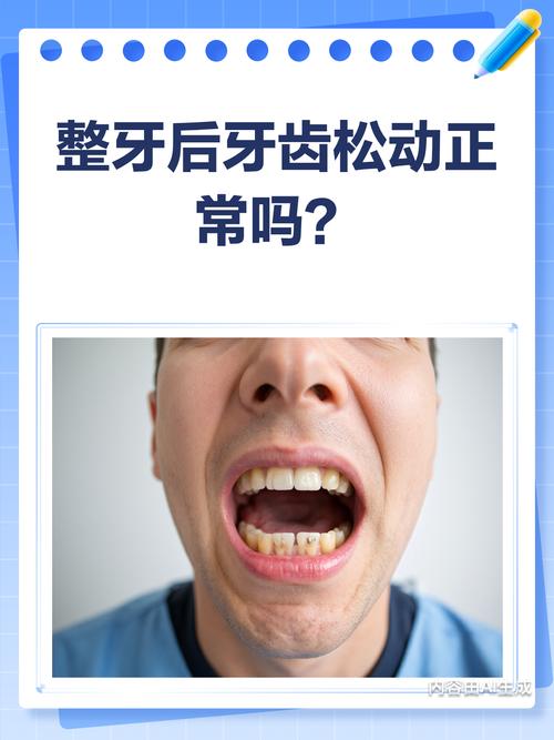 矫正牙齿松动是什么原因导致的？-图1