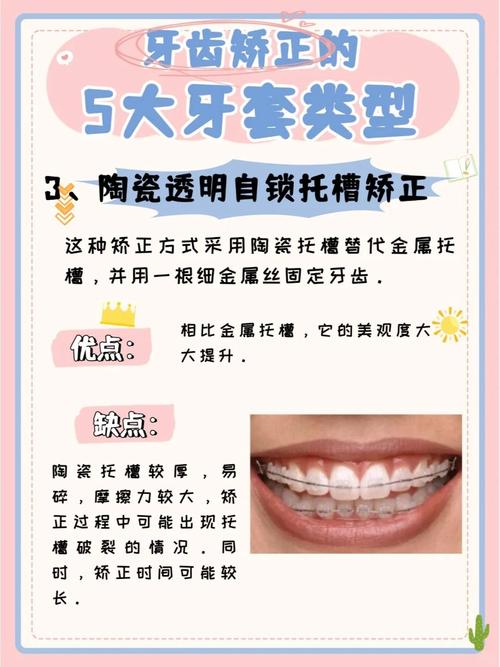 牙齿矫正工具有哪些？新手必看工具清单-图1