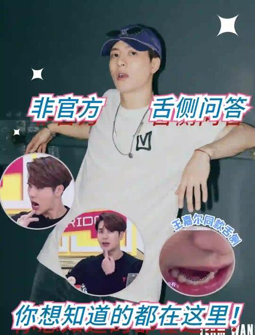 明星在哪矫正牙齿-图1 明星在哪矫正牙齿-图1