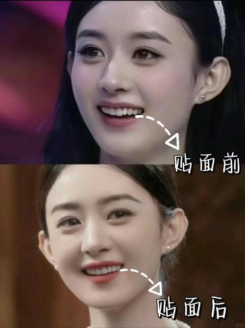明星在哪矫正牙齿-图2 明星在哪矫正牙齿-图2
