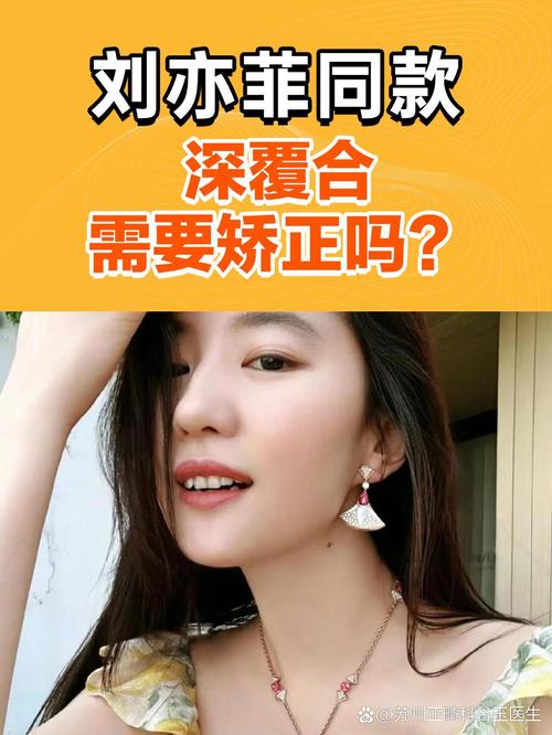 明星在哪矫正牙齿-图3 明星在哪矫正牙齿-图3