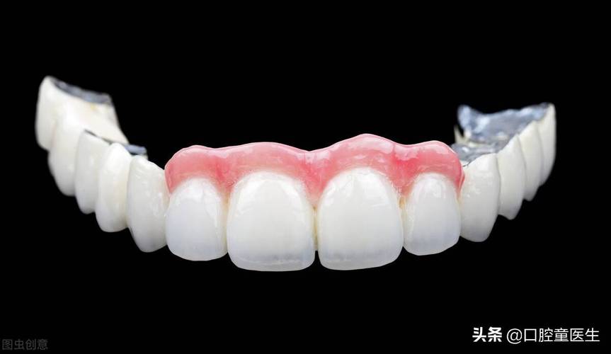 牙齿矫正烤瓷牙图片效果如何？真实案例能参考吗？-图3