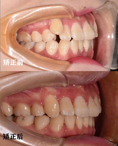 上海牙齿矫正最好怎么选？关键评判标准有哪些？-图1