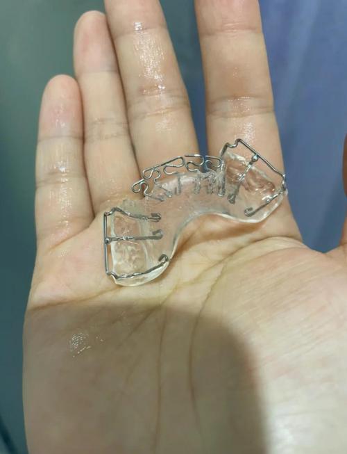 上海牙齿矫正最好怎么选？关键评判标准有哪些？-图2