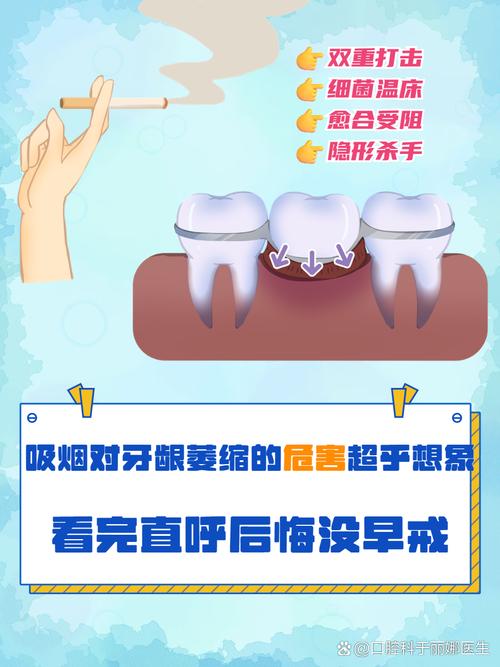 矫正牙齿期间抽烟，可以吗？会有哪些危害？-图2