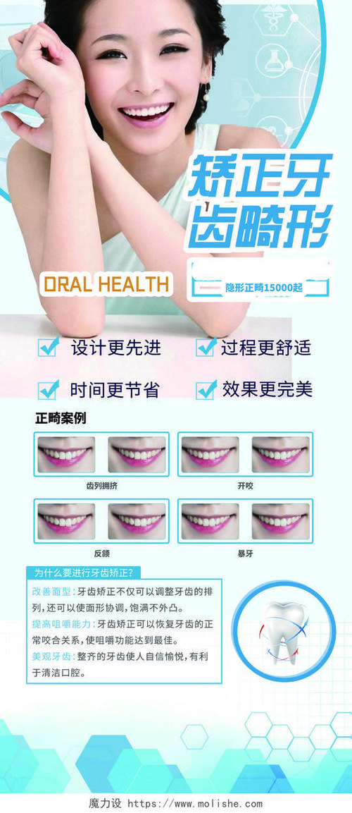 矫正牙齿推广活动，如何趁活动高效又省钱矫正？-图2