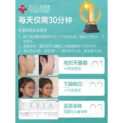 牙齿矫正后,恢复训练为何至关重要?-图3 牙齿矫正后,恢复训练为何至关重要?-图3