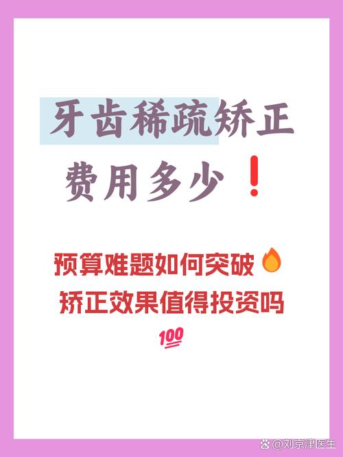 矫正稀疏牙齿费用多少？哪些因素影响价格高低？-图2