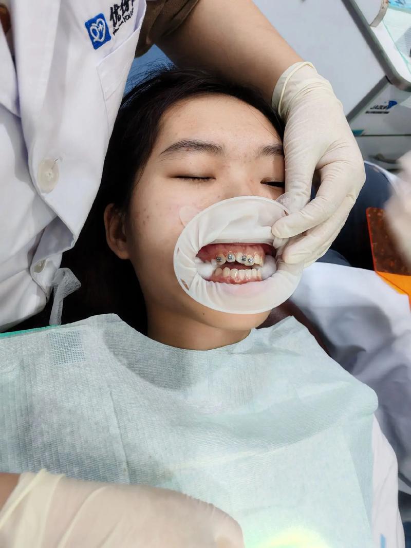 武汉卫校学生矫正牙齿，医院怎么选？费用和流程如何？-图1